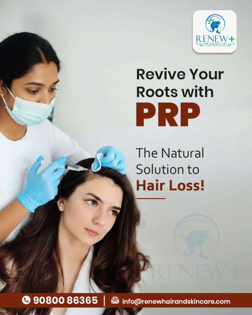 PRP Treatment in Salem for hair