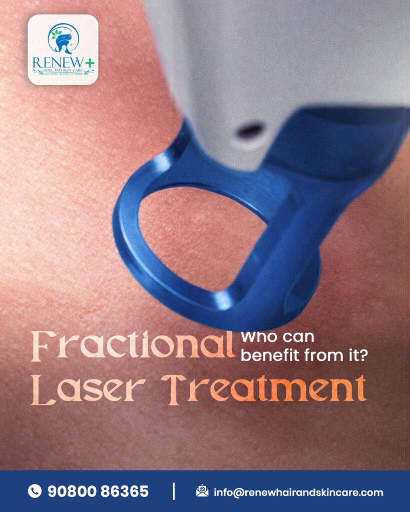 laser treatment for hair and skin