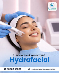 Hydrafacial for skin 