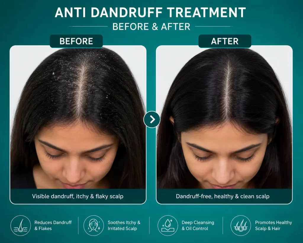 anti dandruff treatment in tiruvallur