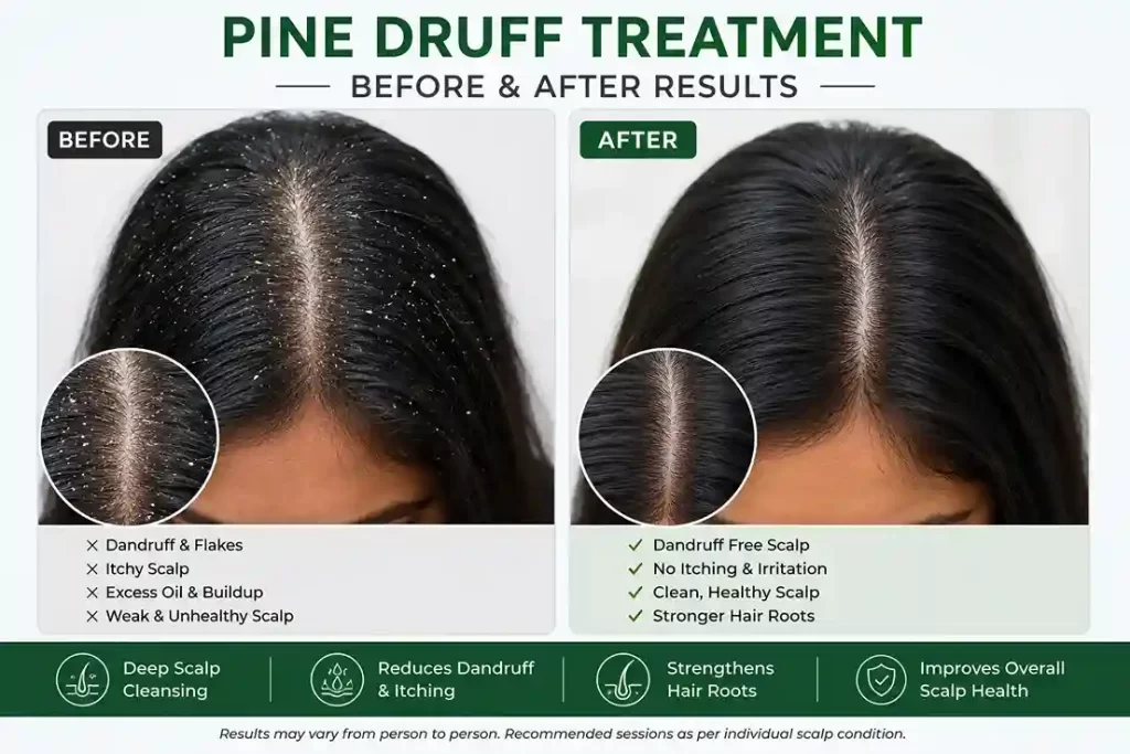 Results for Pinedruff Treatment in salem