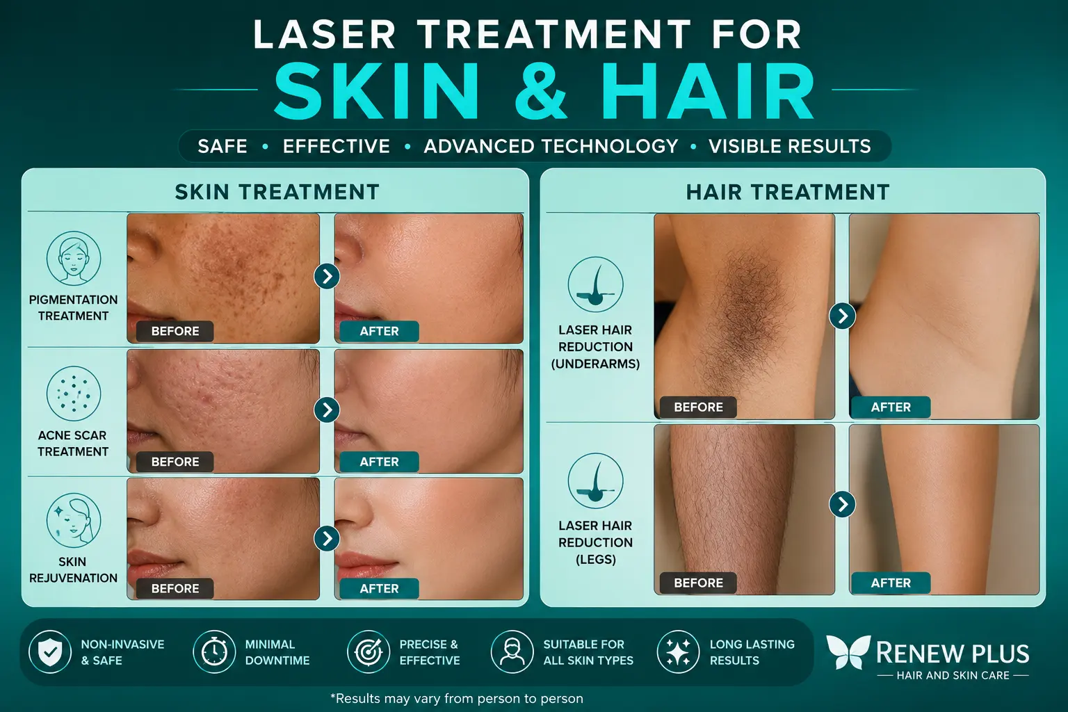 laser treatment in salem for hair and skin
