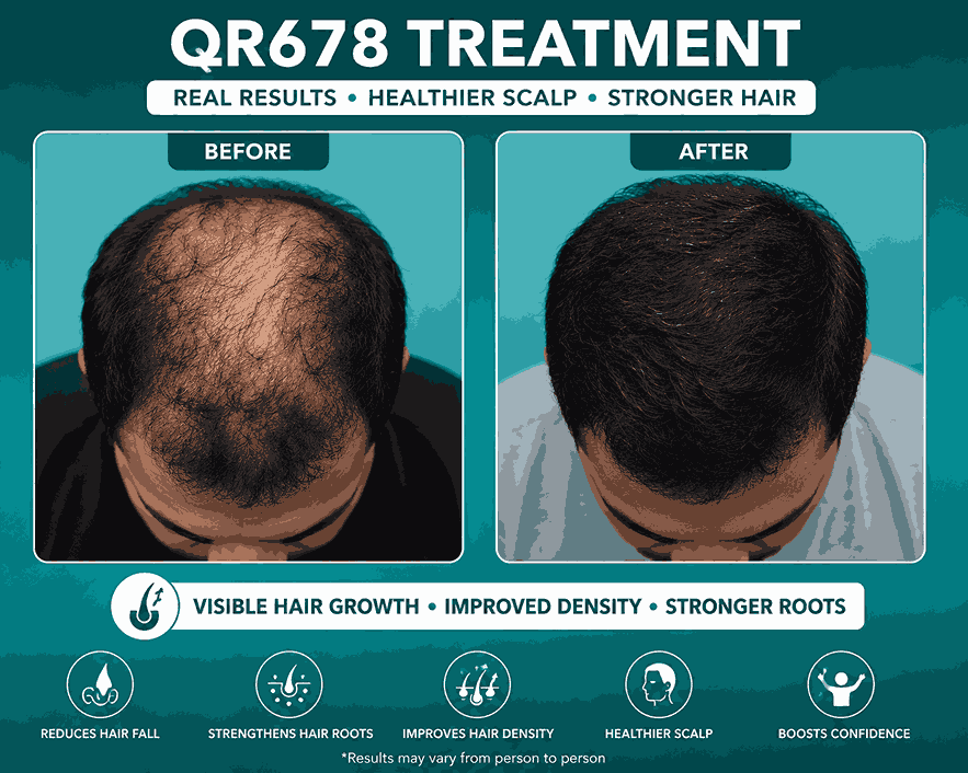 QR678 Treatment in salem Results