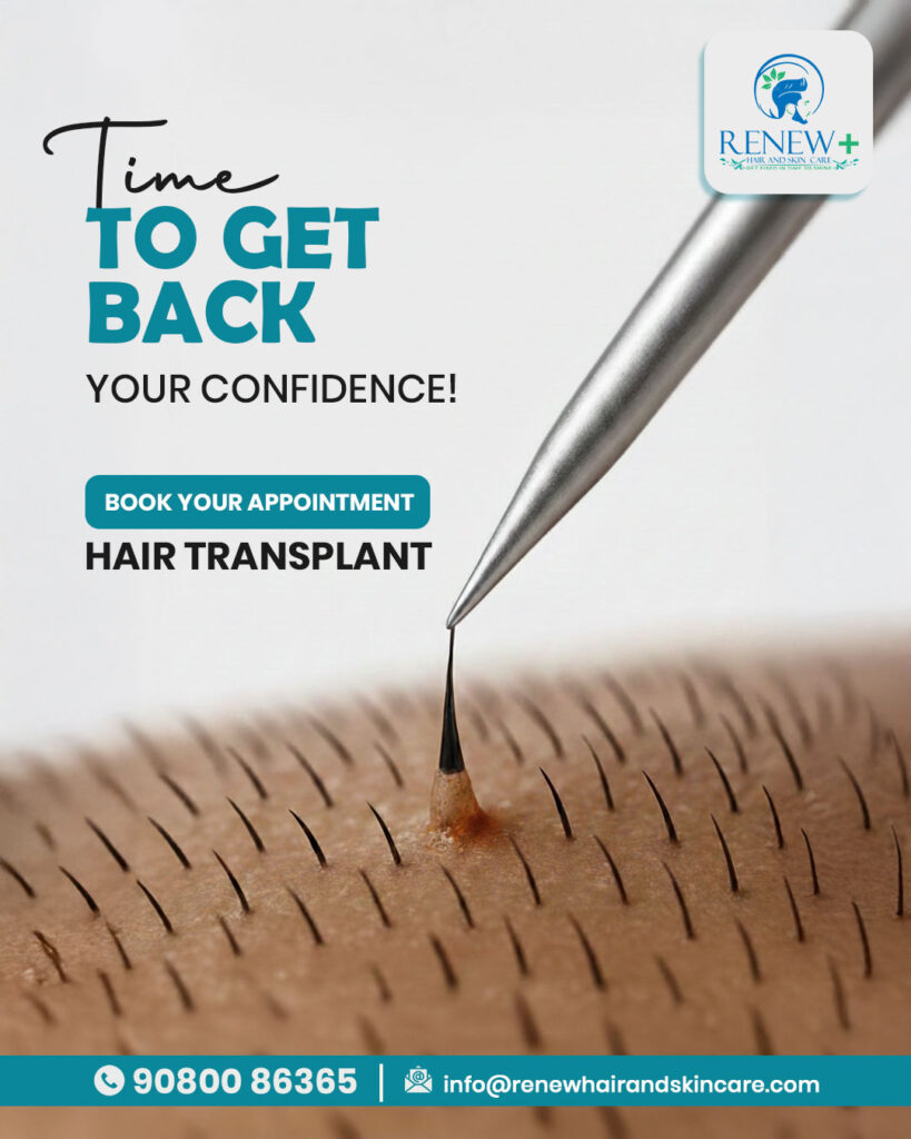 hair transplant in medavakkam
