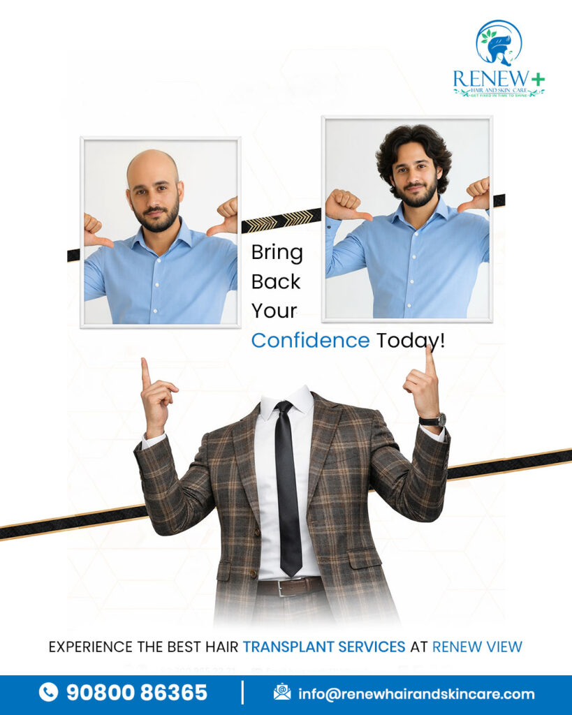 natural looking results after hair transplant