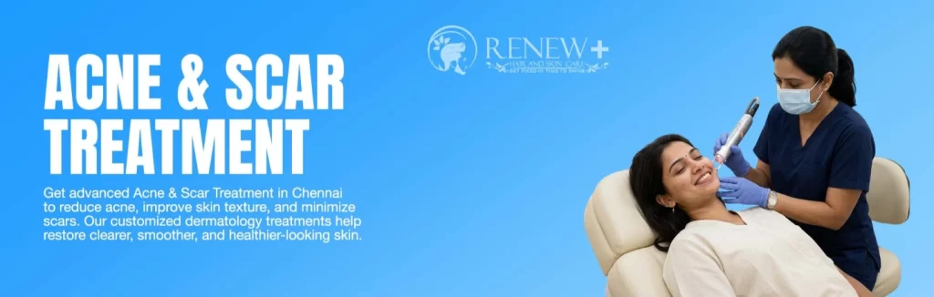 acne and scar treatment medavakkam