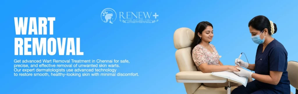 wart removal medavakkam
