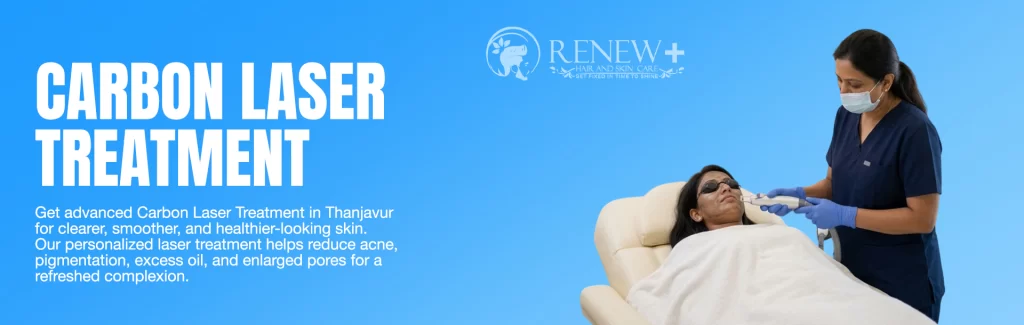 carbon laser treatment in thanjavur post