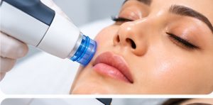 Hydrafacial Treatment