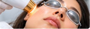 Q Switch Laser Treatment
